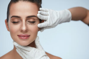 A doctor marking a woman’s eye for eyelid surgery